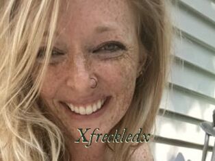 Xfreckledx